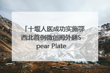 十堰人医成功实施鄂西北首例微创拇外翻Spear Plate髓内板矫形术